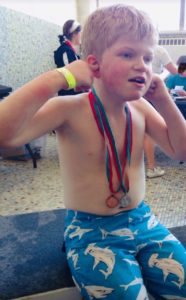 Boy with Smith-Kingsmore syndrome in a swim suit with medals around his neck at the Special Olympics