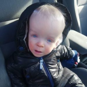 Baby with Smith-Kingsmore syndrome